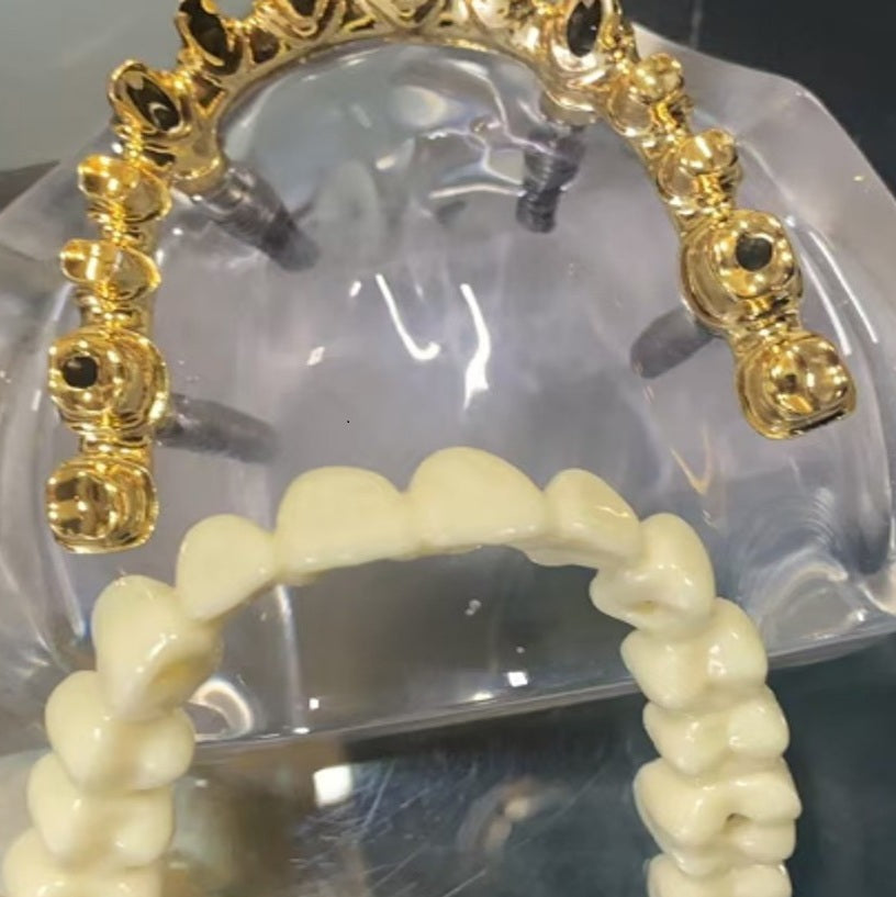 Aesthetic Bridge 4 Implant by Dental Mates
