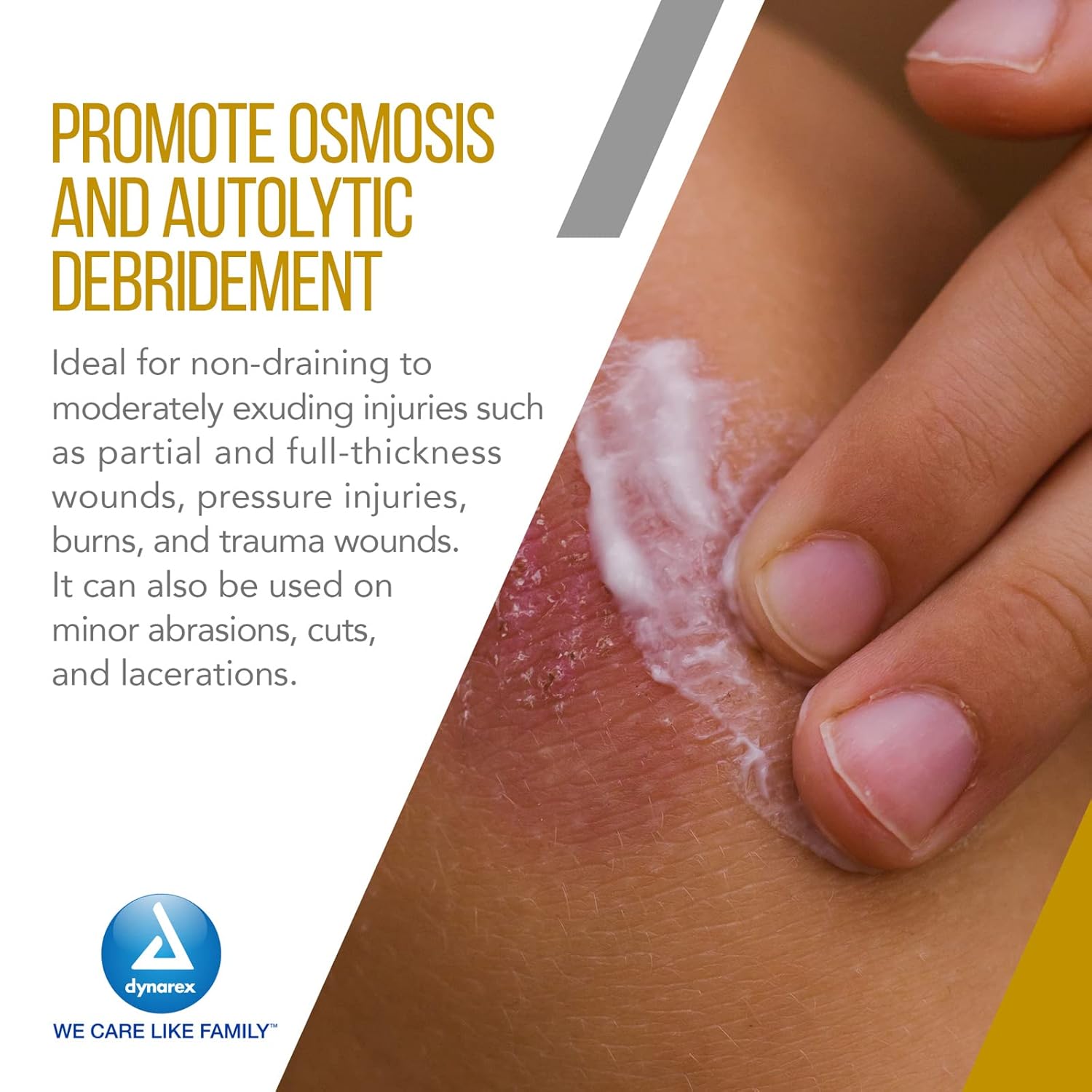 Dynarex L-Mesitran Soft, 1.75 oz. Tube, 24tube/case (24 Count)