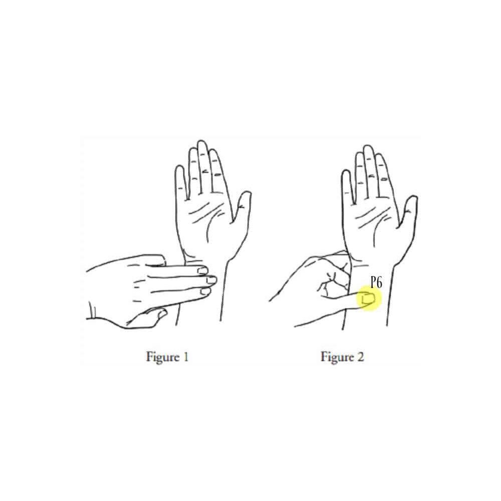 morning sickness acupressure sea bands