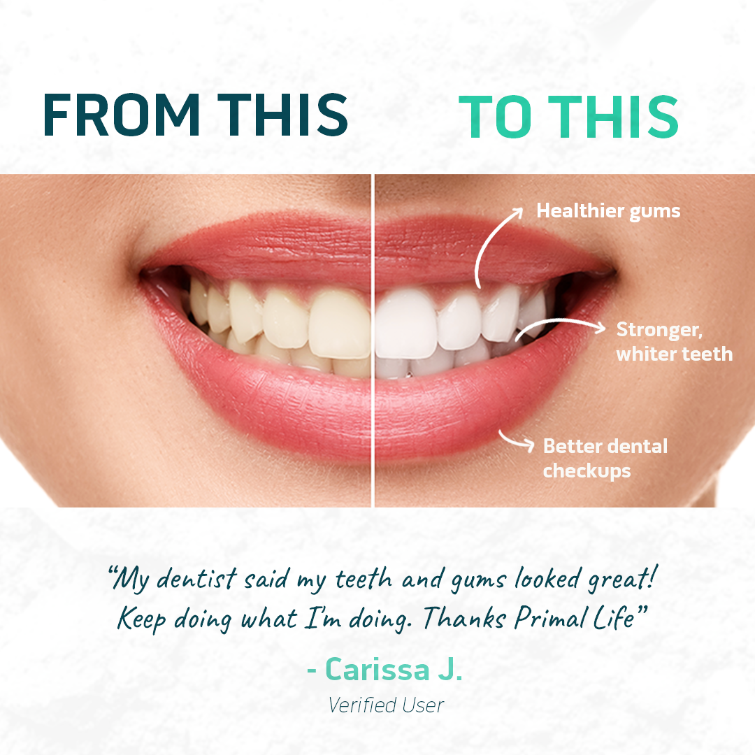 Dental DETOX KIT by Primal Life Organic II LLC